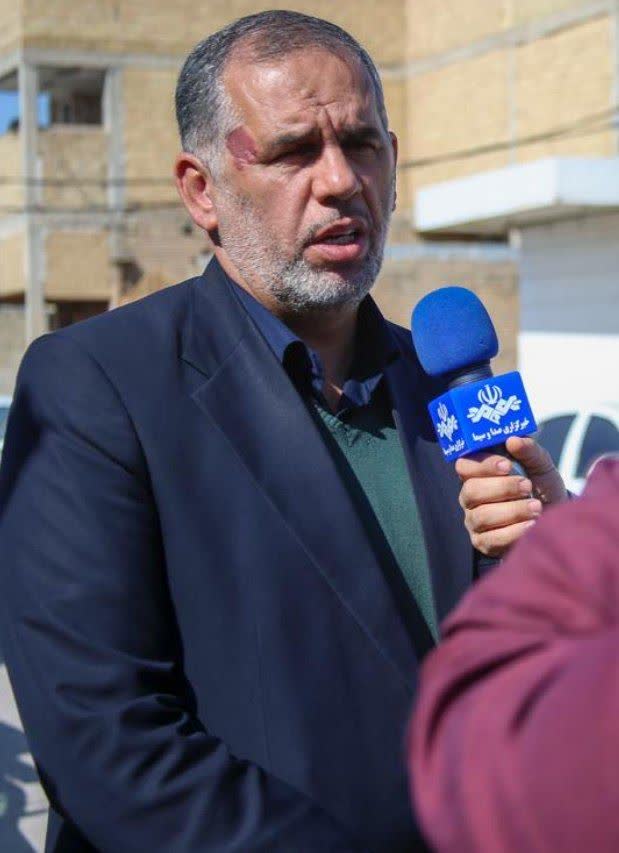 موسوی‌زاده: افزایش بیماران تنفسی در اهواز زنگ هشدار جدی برای مسئولان است